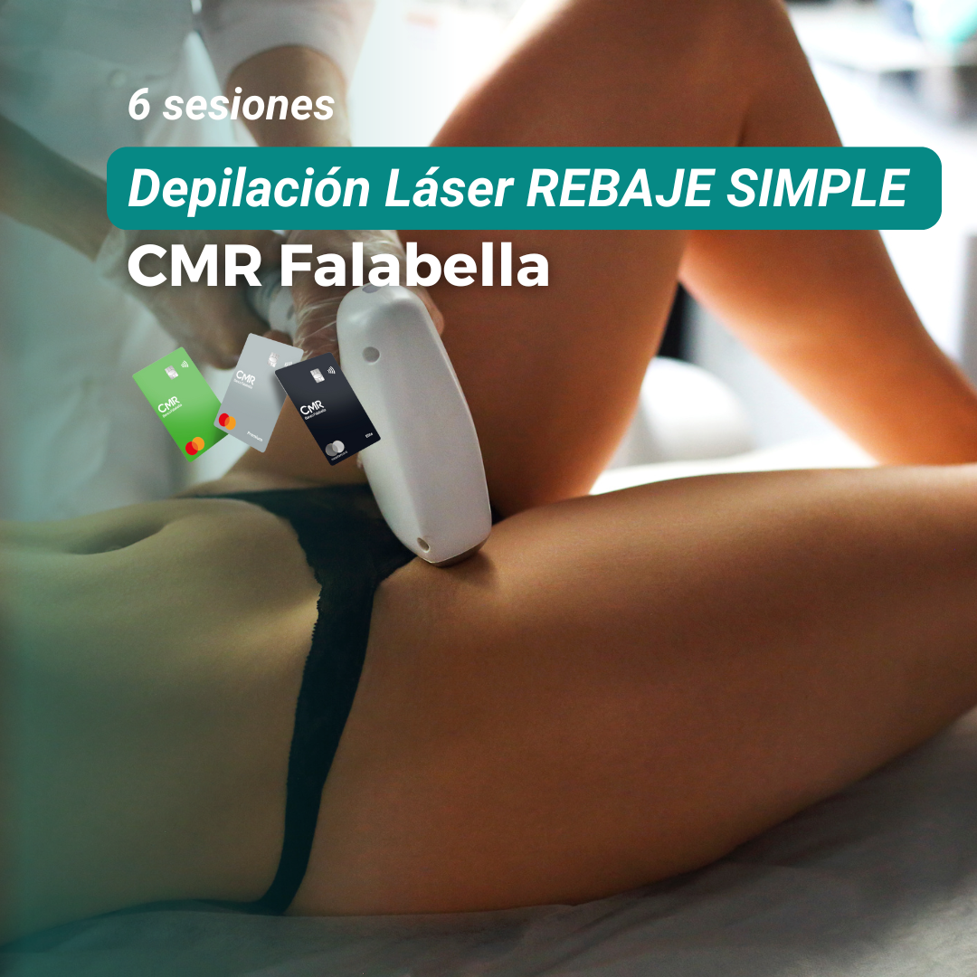 DESCUENTO CMR: 6 sesiones Rebaje Simple