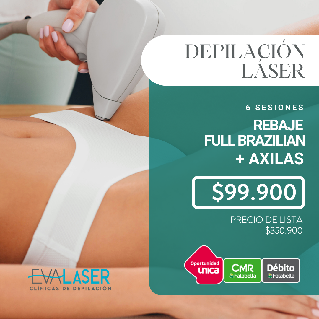 Depilacion laser full brazilian sale